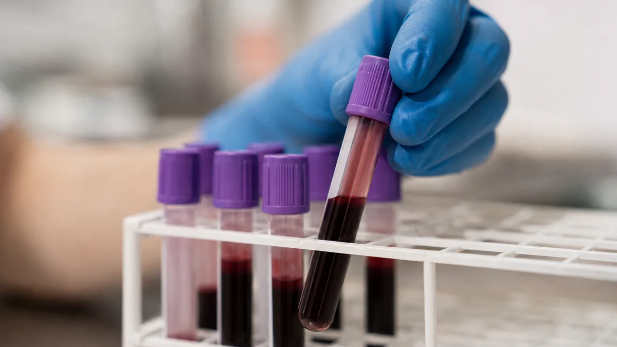 Bezpłatne badania w Łodzi. NFZ finansuje krew, kolonoskopię i cytologię