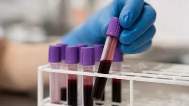 Bezpłatne badania w Łodzi. NFZ finansuje krew, kolonoskopię i cytologię
